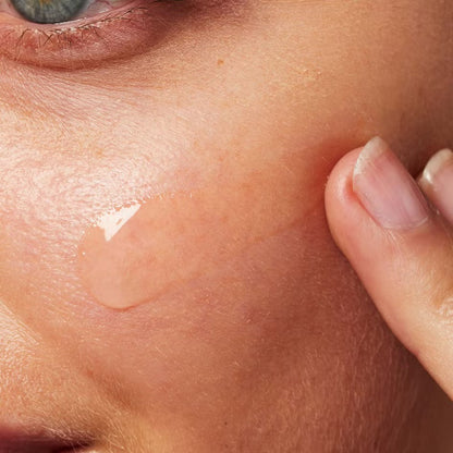 CeraVe Resurfacing Retinol Serum with Ceramides and Niacinamide for Blemish-Prone Skin 30ml