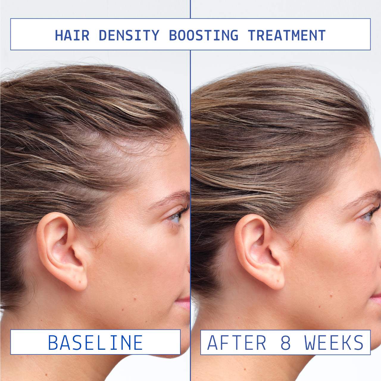 AAVRANI Mini Strengthening Hair Oil & Growth Serum Gift Set