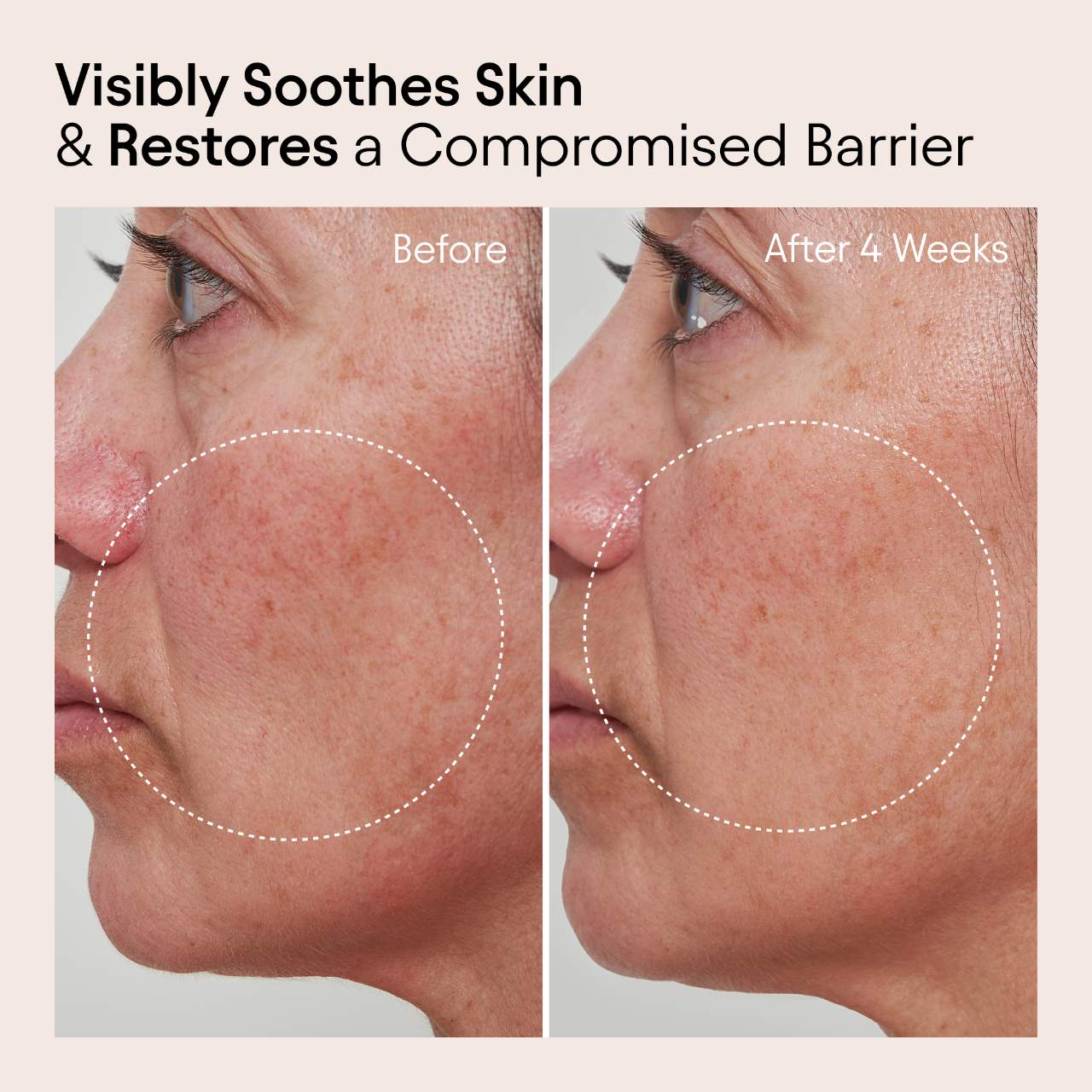 ALPYN Super Peptide & Ghostberry Moisturizer for Eczema, Barrier and Wrinkle Repair