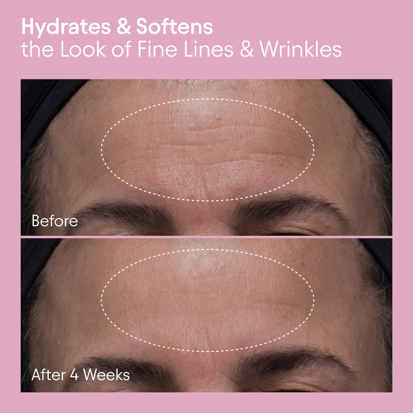 ALPYN Melt Moisturizer for Firming, Plumping & Brightening