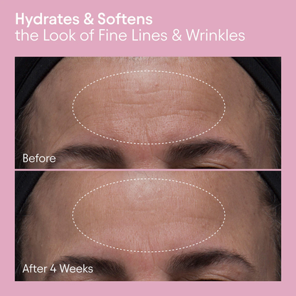 ALPYN Melt Moisturizer for Firming, Plumping & Brightening