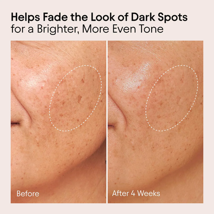 ALPYN Vitamin C & Bearberry Instant Brightening Serum