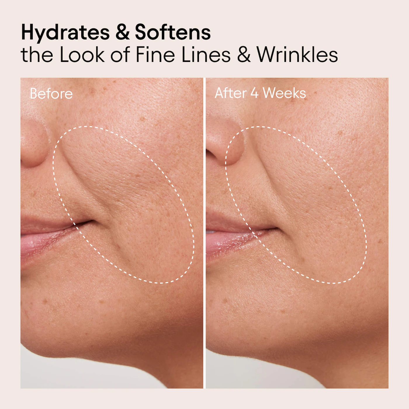 ALPYN Melt Moisturizer for Firming, Plumping & Brightening