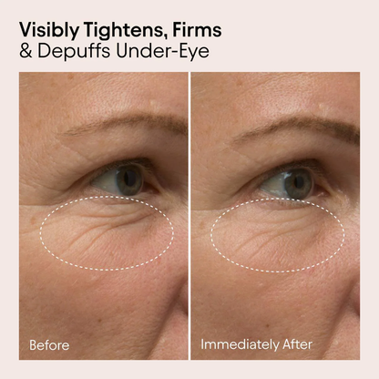 ALPYN Line-Filling Eye Cream For Firming & De-Puffing