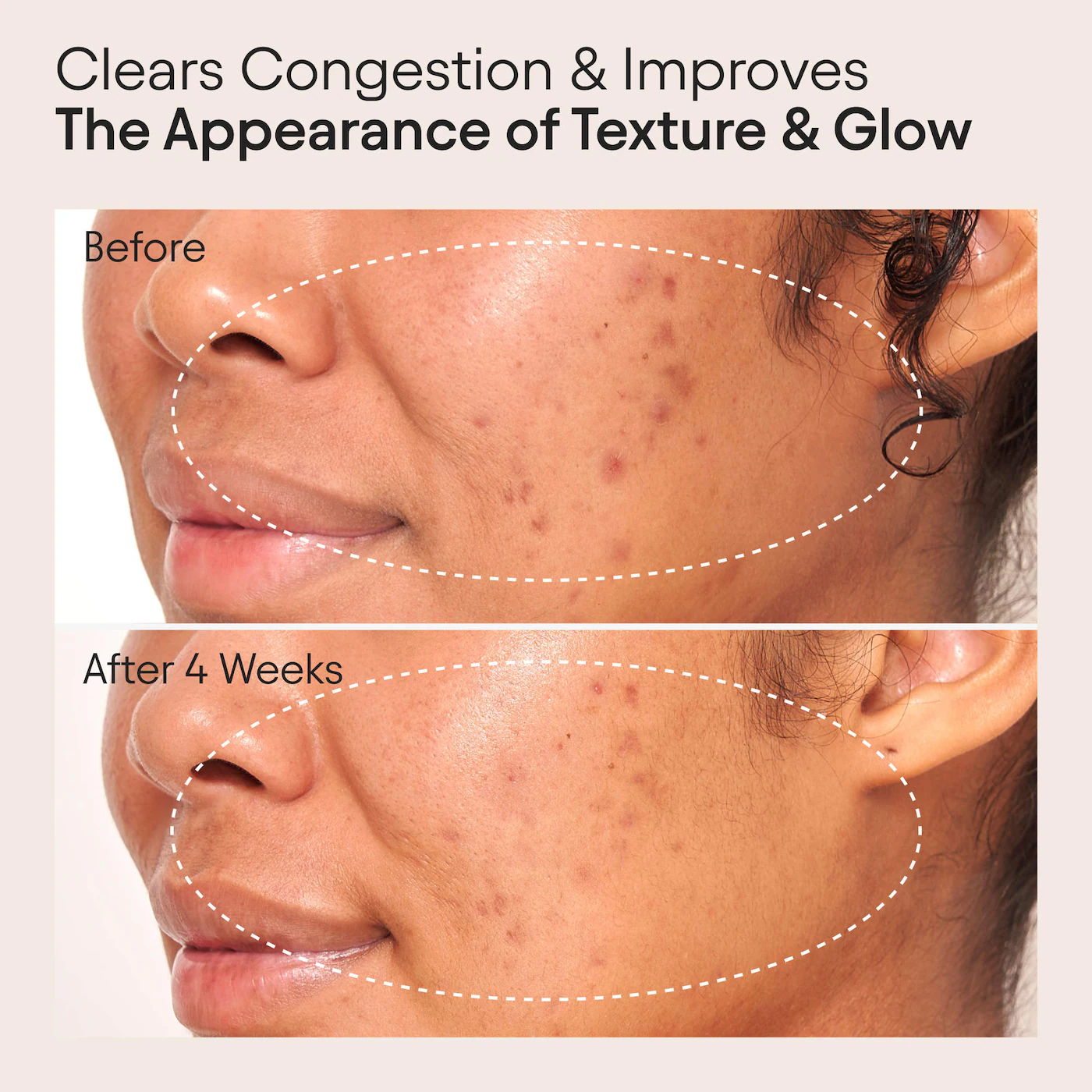 ALPYN Retinol Clarifying Oil for Congestion & Wrinkles