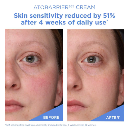 AESTURA ATOBARRIER365 Cream Moisturizer with Ceramides & Niacinamide for Skin Moisture Barrier Repair