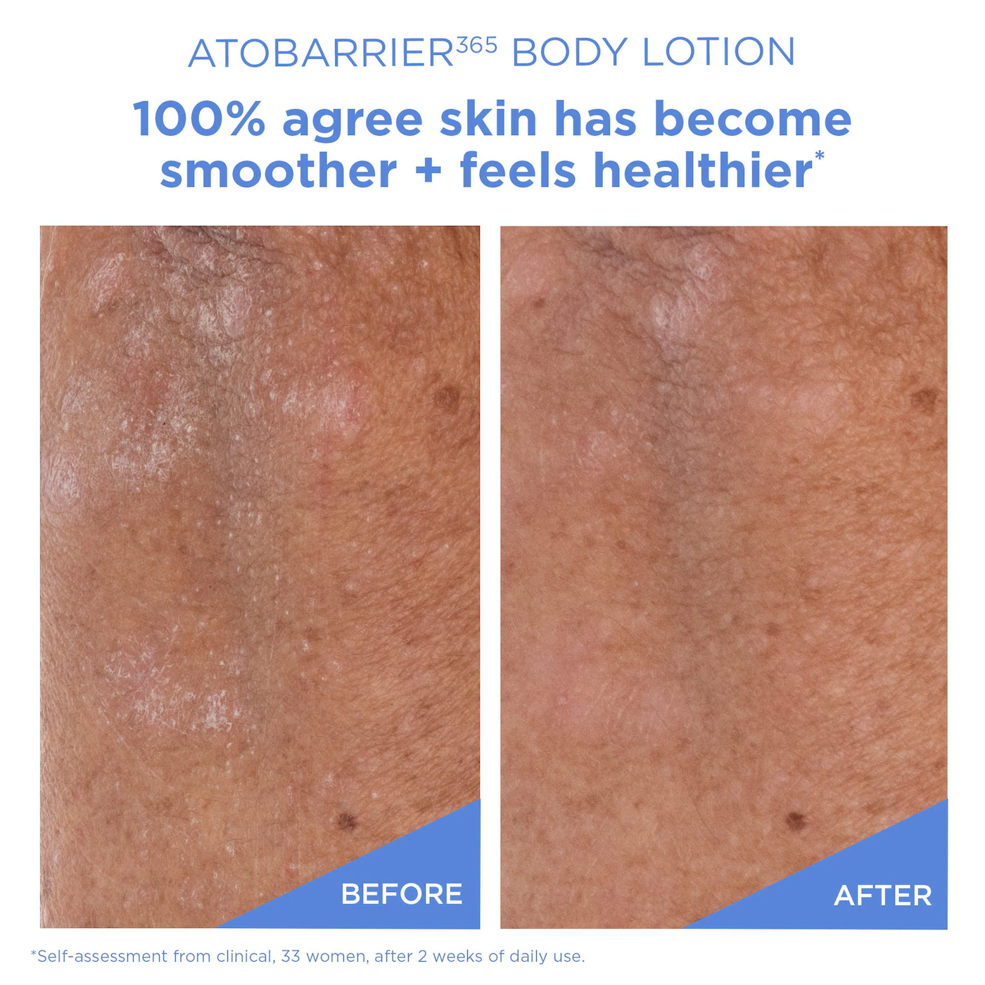 AESTURA ATOBARRIER365 Moisturizing Body Lotion with Ceramides for Dry & Sensitive Skin