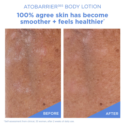 AESTURA ATOBARRIER365 Moisturizing Body Lotion with Ceramides for Dry & Sensitive Skin