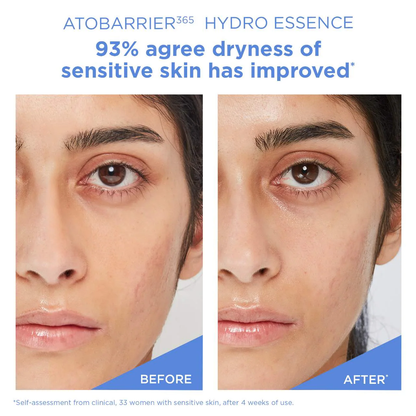 AESTURA ATOBARRIER365 Hydro Essence with Hydrating Amino Acids for Skin Moisture Barrier Repair