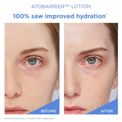 AESTURA ATOBARRIER365 Lightweight Face Lotion Moisturizer with Ceramides & Niacinamide for Skin Moisture Barrier Repair