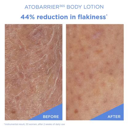 AESTURA ATOBARRIER365 Moisturizing Body Lotion with Ceramides for Dry & Sensitive Skin