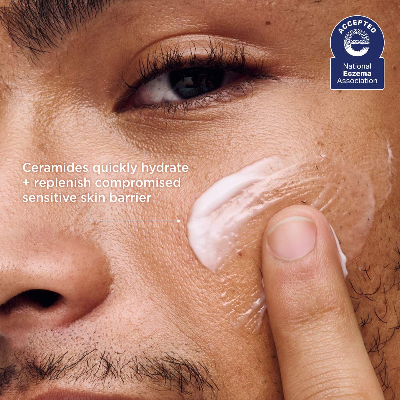 AESTURA ATOBARRIER365 Lightweight Face Lotion Moisturizer with Ceramides & Niacinamide for Skin Moisture Barrier Repair