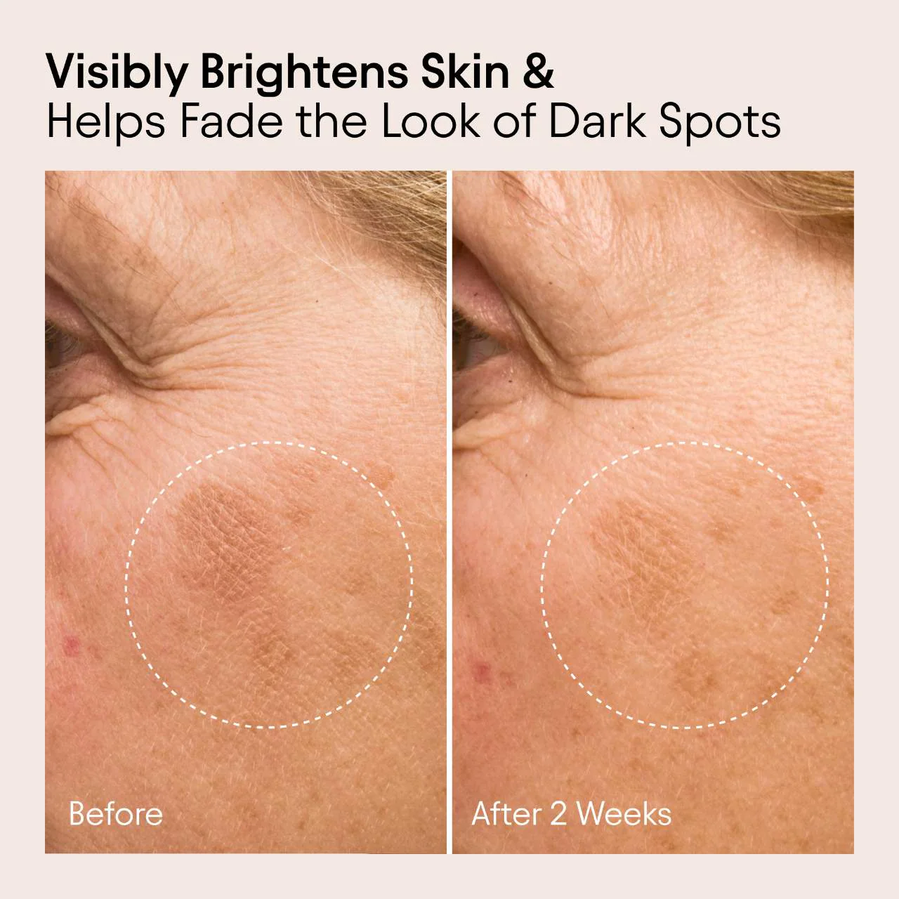 ALPYN Vitamin C & Bearberry Instant Brightening Serum