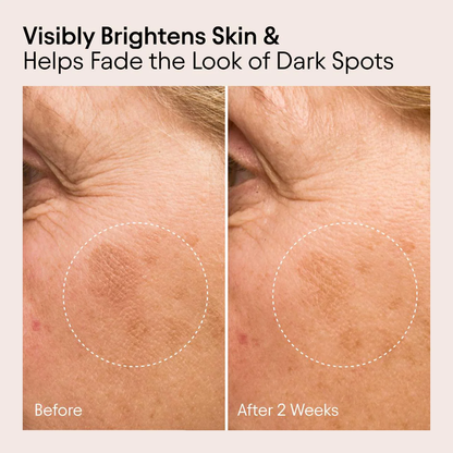 ALPYN Vitamin C & Bearberry Instant Brightening Serum