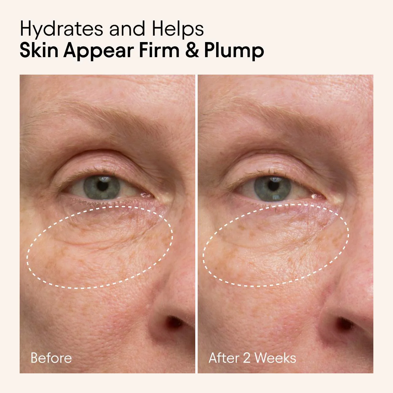 ALPYN Hydrating Firming Serum with Niacinamide & Nettle