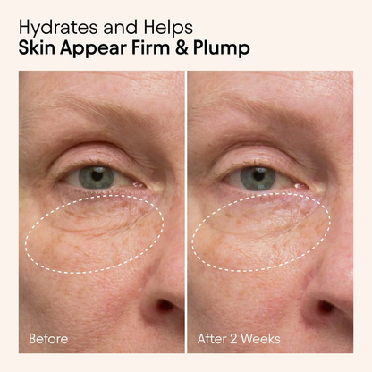 ALPYN Hydrating Firming Serum with Niacinamide & Nettle