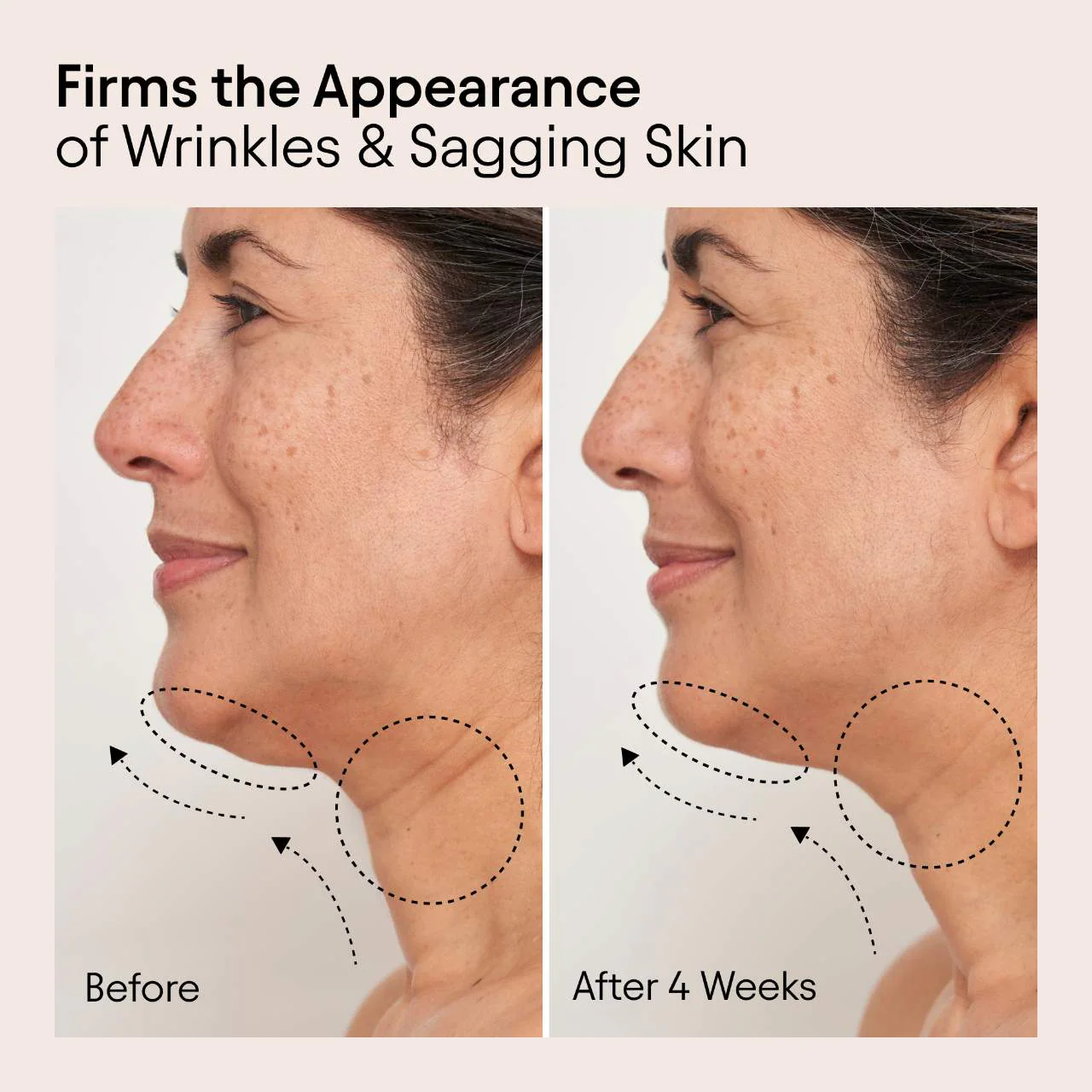 ALPYN Super Sculpt Serum For Face & Neck with Tri-Peptide Firming Complex