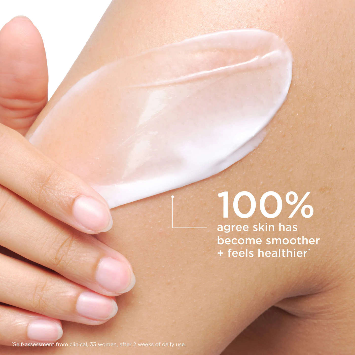 AESTURA ATOBARRIER365 Moisturizing Body Lotion with Ceramides for Dry & Sensitive Skin