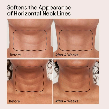 ALPYN Super Sculpt Serum For Face & Neck with Tri-Peptide Firming Complex