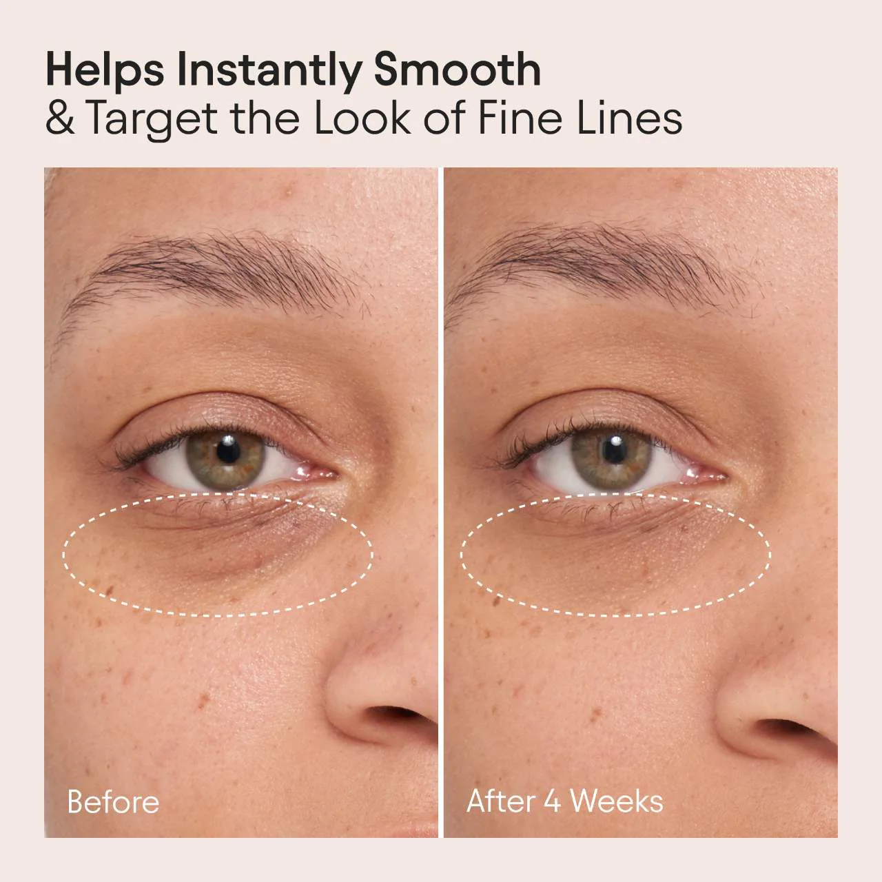 ALPYN Line-Filling Eye Cream For Firming & De-Puffing