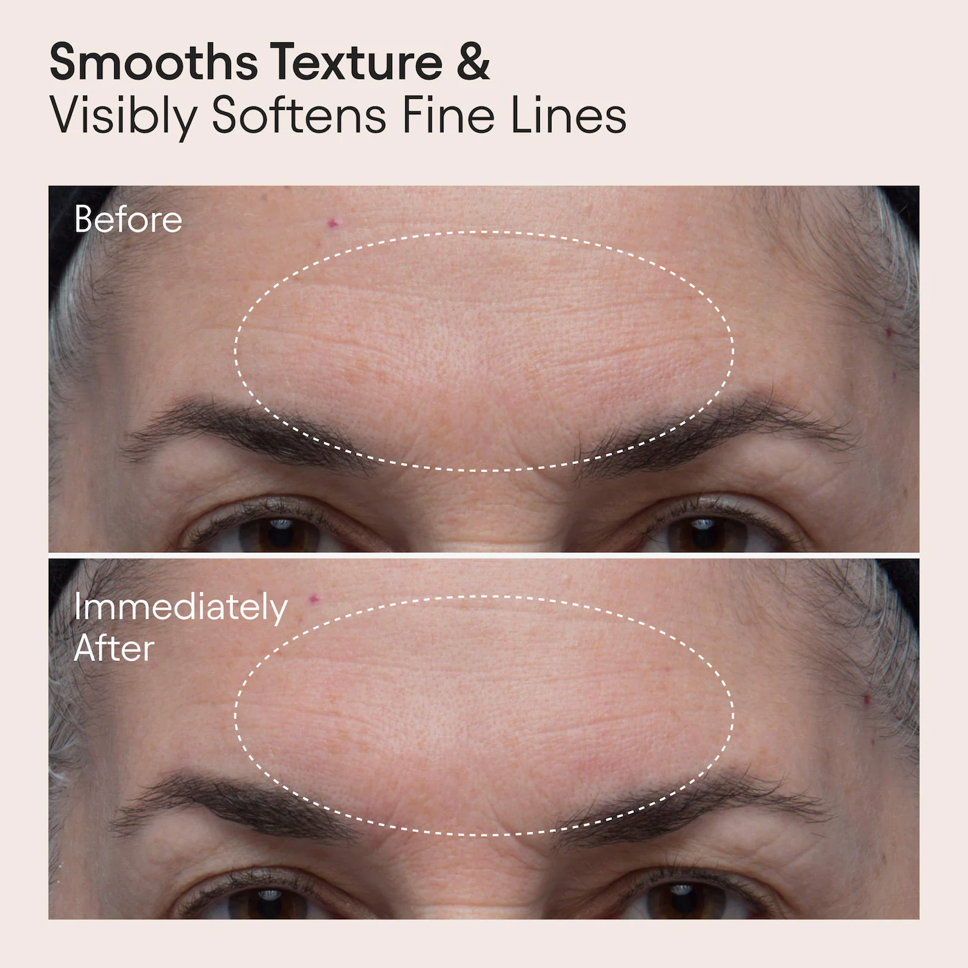 ALPYN Polishing Peel & Brightening Face Mask with 8 Acids & Huckleberry