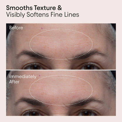 ALPYN Polishing Peel & Brightening Face Mask with 8 Acids & Huckleberry