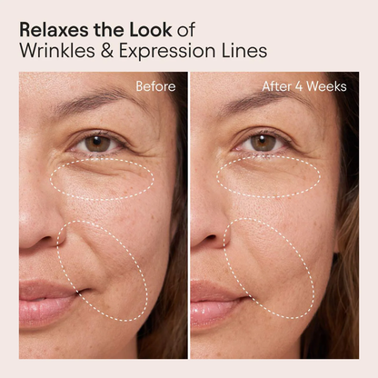 ALPYN Super Peptide & Ghostberry Moisturizer for Eczema, Barrier and Wrinkle Repair